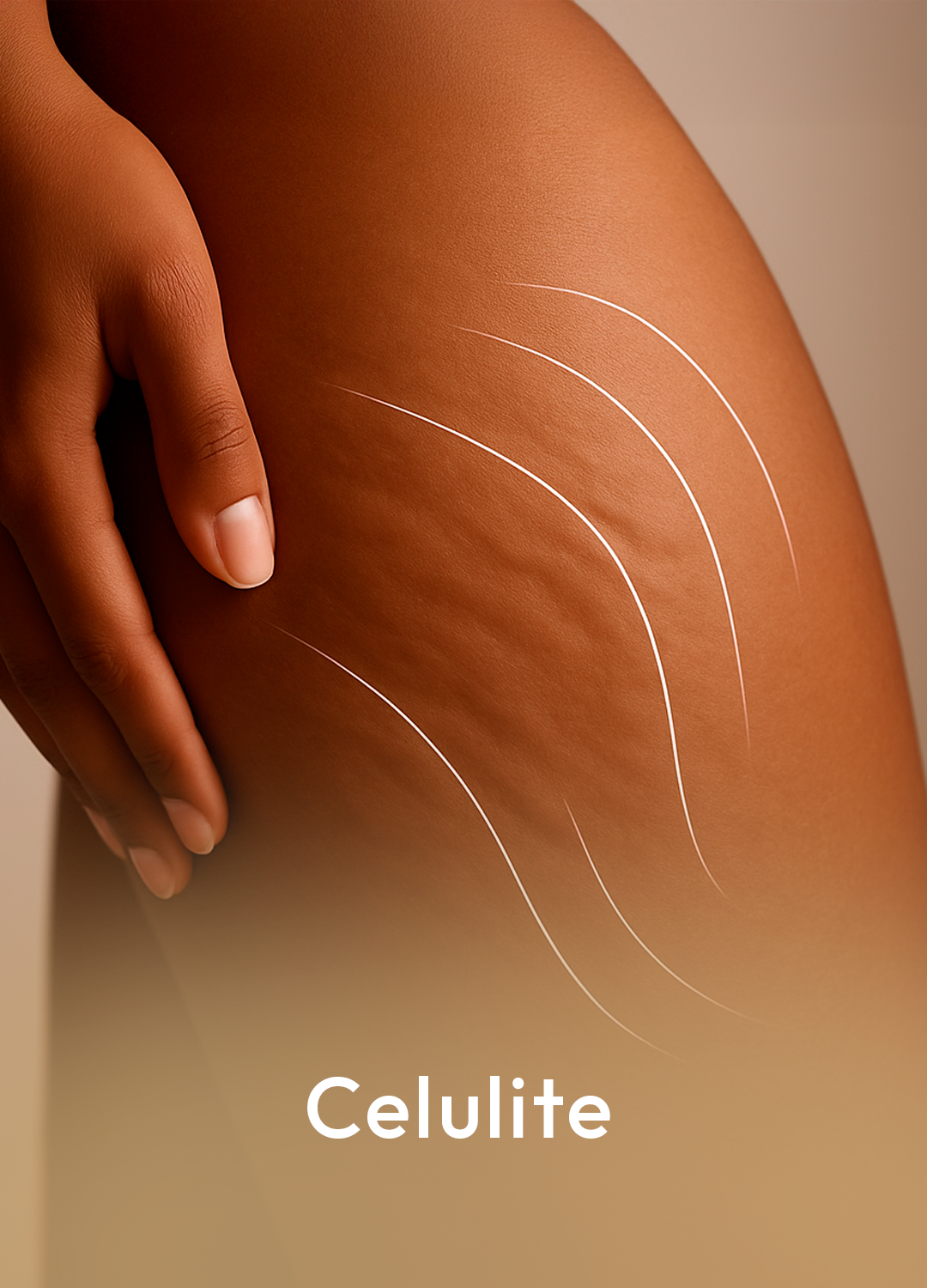 celulite