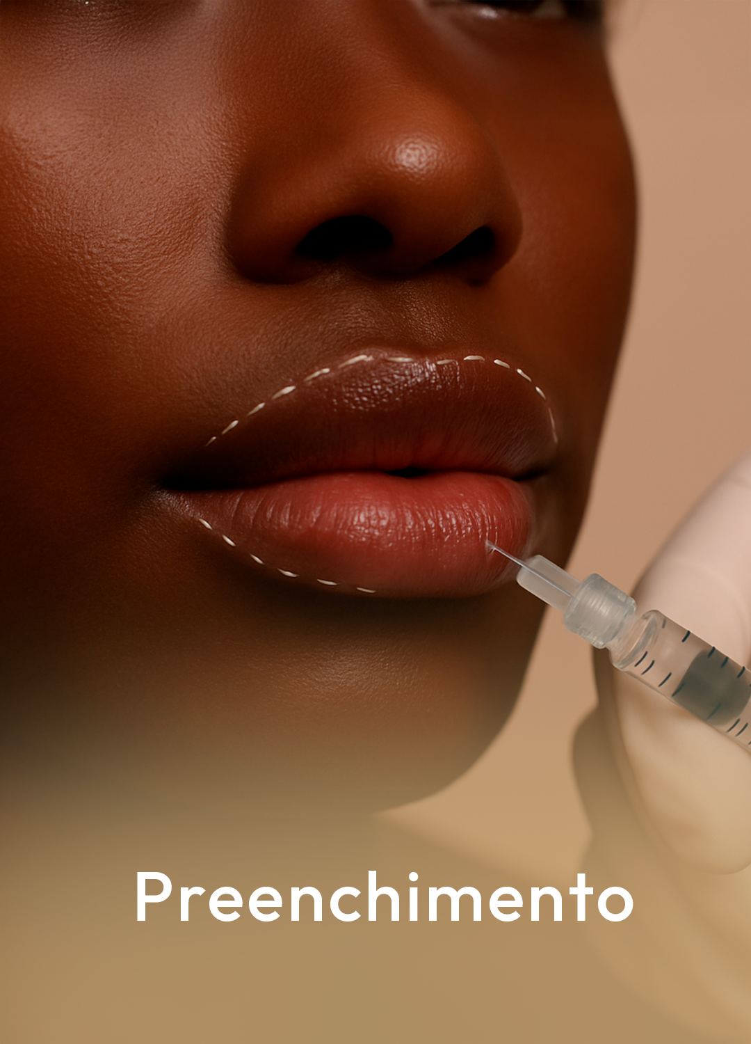 preenchimento